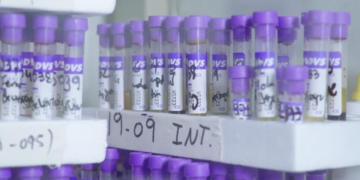 Estudian respuestas de anti-cuerpos de las vacunas contra en covid en 3 continentes